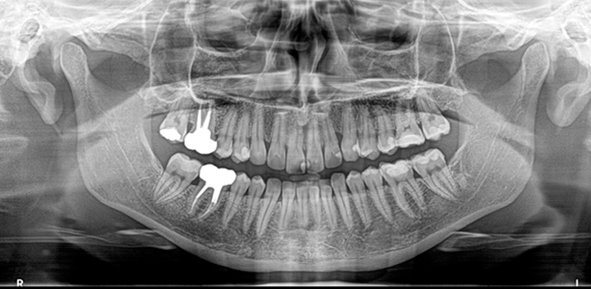 Oral Diagnoz - Radyoloji